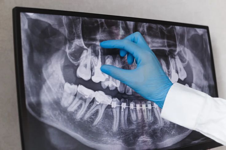 When Do You Know It’s Time to Consider Jaw Surgery?